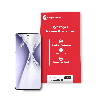 Honor-X20-SE-Repair-Mate-Hydrogel-Screen-Protector.png