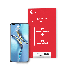 Honor-X20-Repair-Mate-Hydrogel-Screen-Protector.png